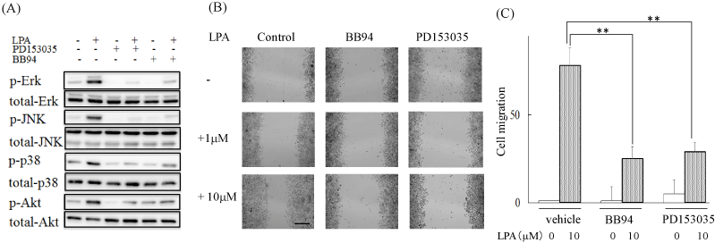 Lysophosphatidic Acid Induces Me180 Cell Migration Emvia