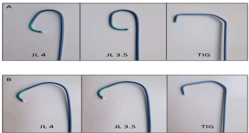 When right is left and left is right: using the JL3.5 guide catheter