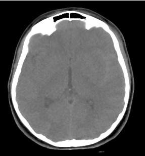 Does my child really need a CT Scan? A retrospective review of use of ...