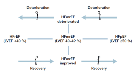 Ejection Fraction Range Chart